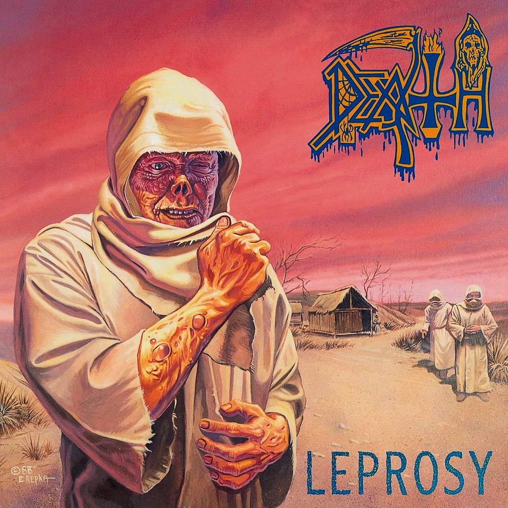 Leprosy